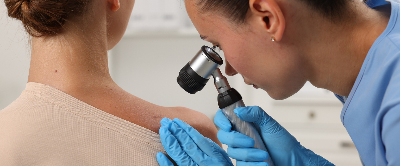 The ABCDEs of Melanoma: How to Check Your Skin for Signs of Skin Cancer