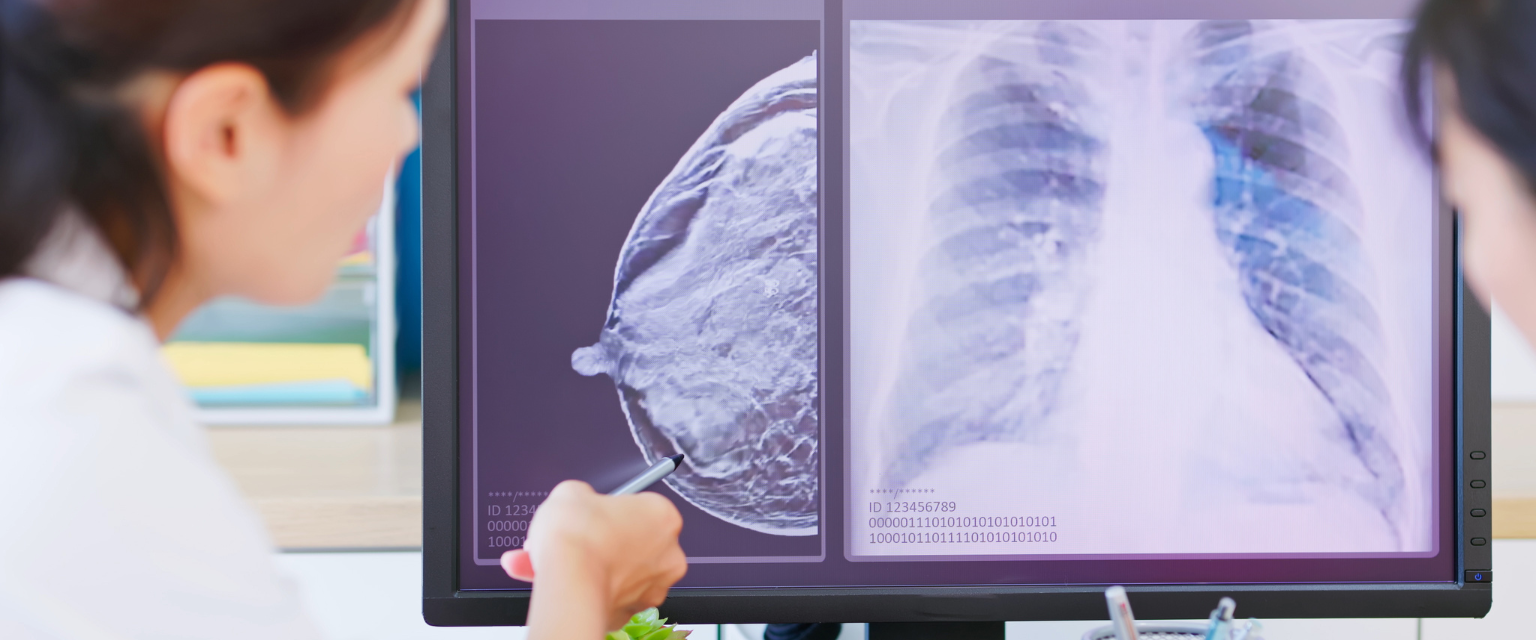 Breast Cancer Risk Factors: What You Can Control—and What You Can’t